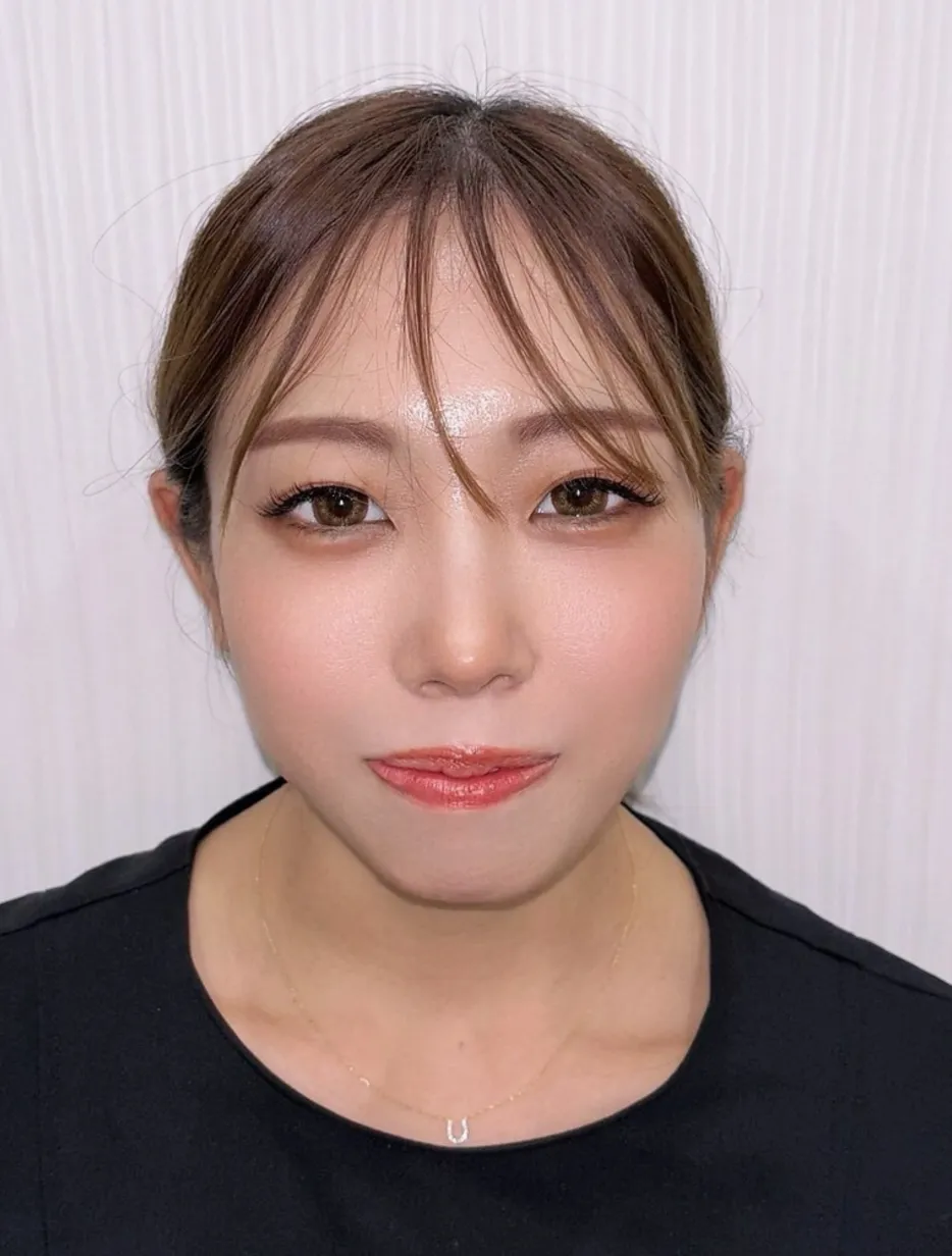 ARISA