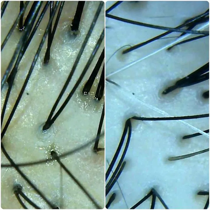 カット＋オイルケア+肌質改善オイルケアシェービング