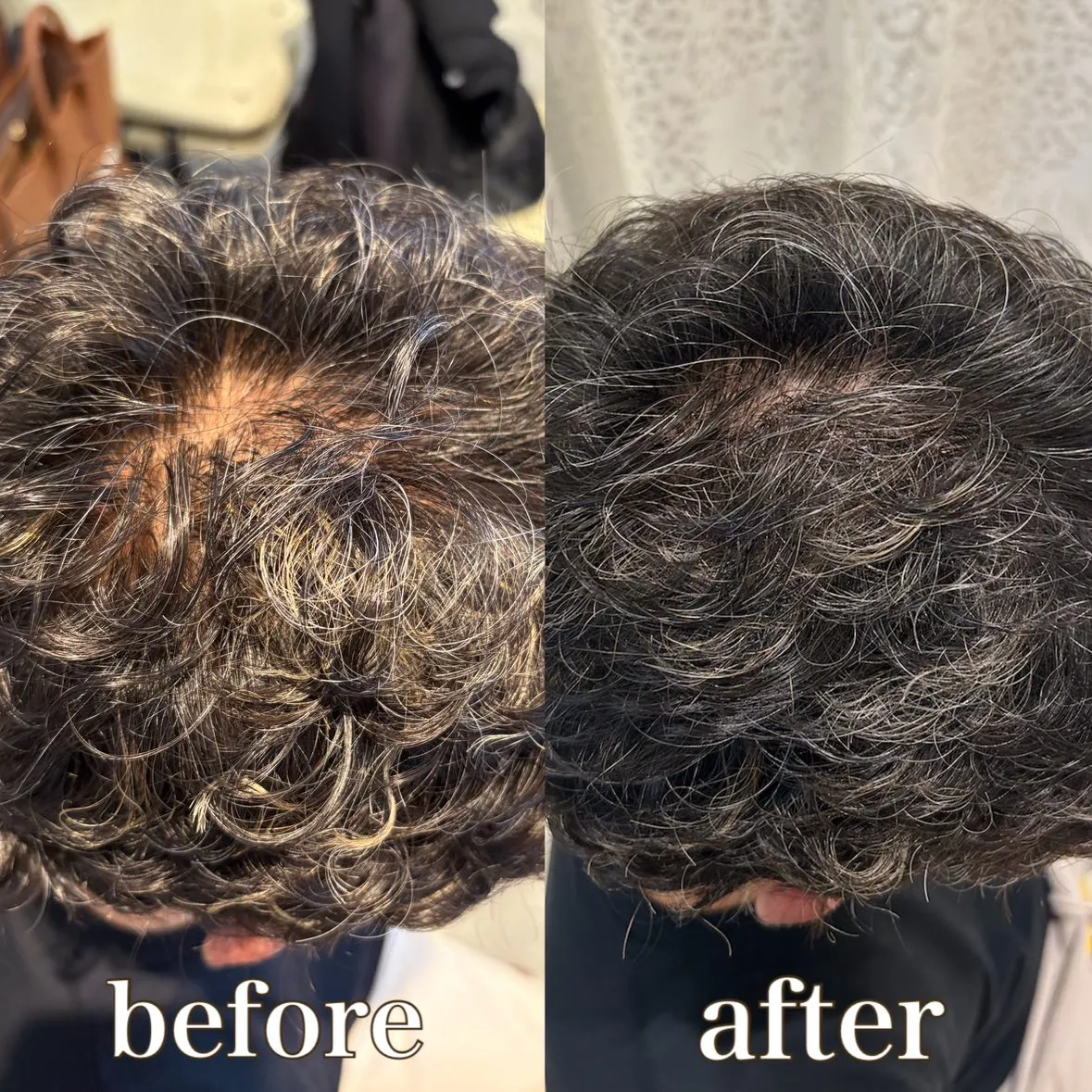 スカルプインク