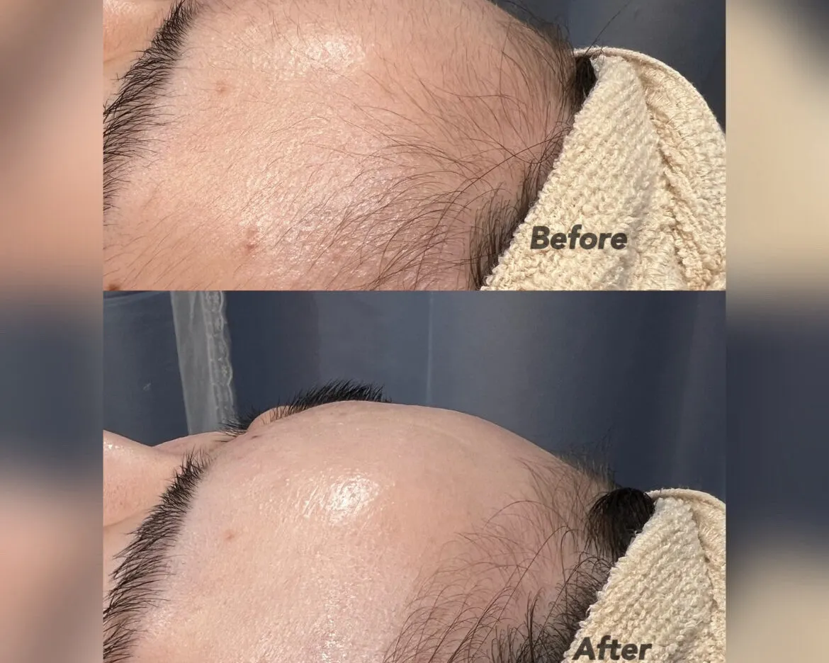 顔+うなじ＋拭き取りパック