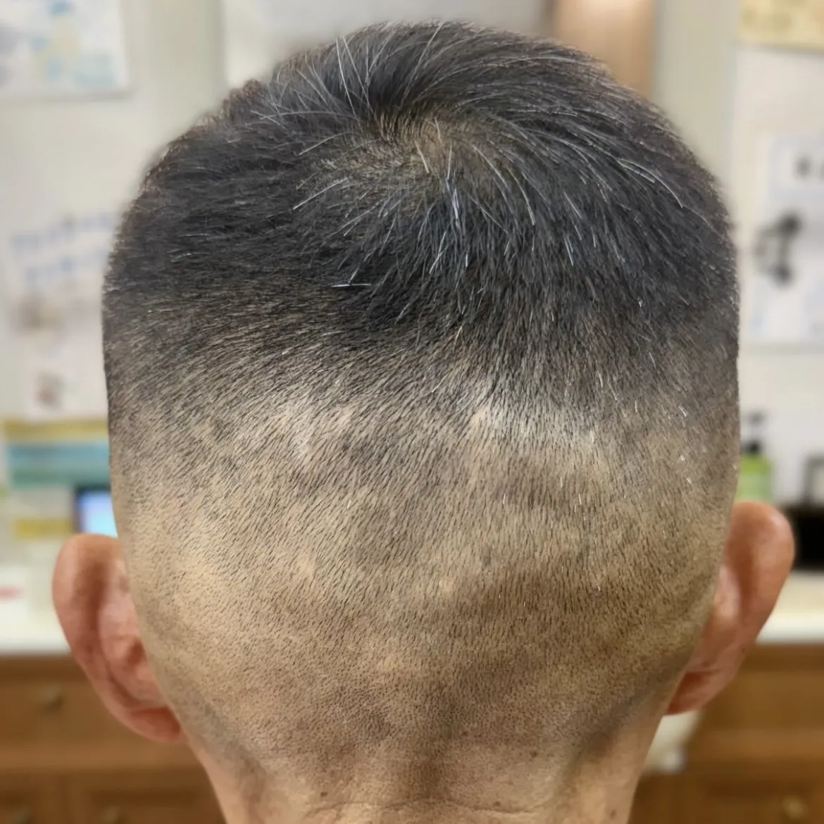 総合調髪+スキンフェード