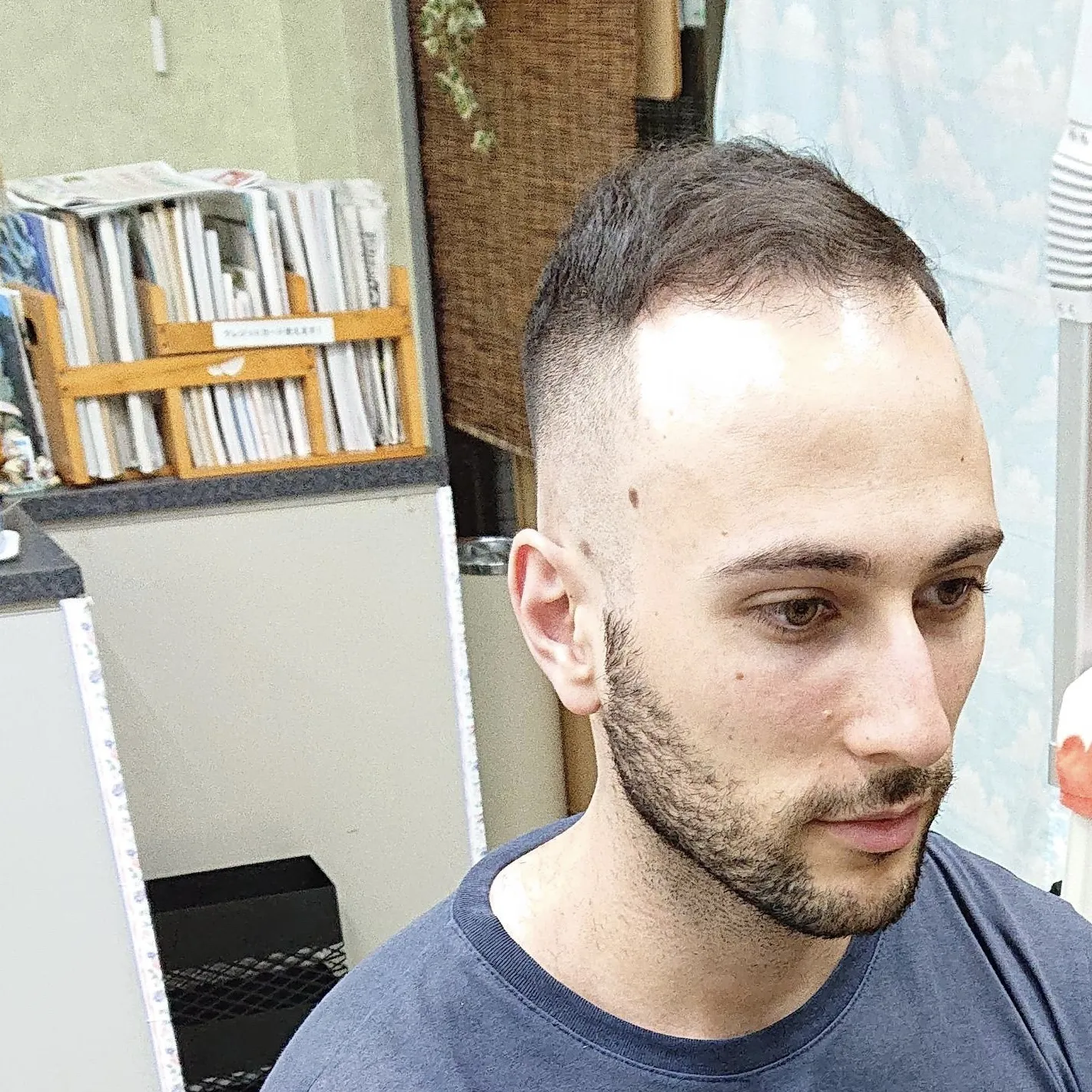 スキンフェード(sp、sv込み)　