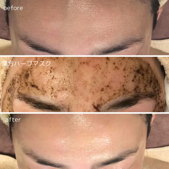 肌育漢方ハーブマスク&シェービング（60分）