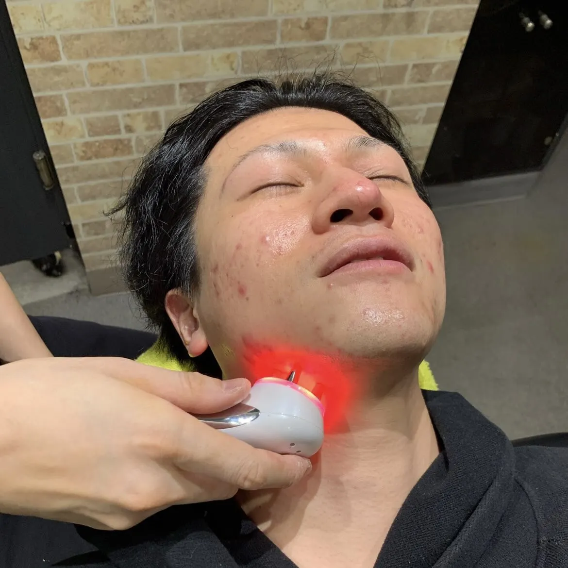 【強髪プログラム】ヒト幹細胞培養液を頭皮につけ、エレクトロポレーションで浸透を促し、ターンオーバーのサイクルを正常化させるというコースです。